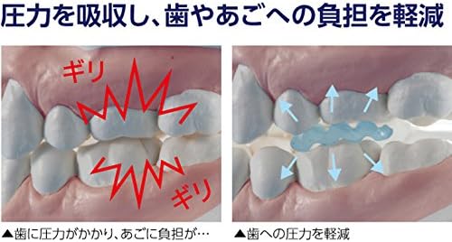 日本製 PROIDEA 矽膠牙套 下排單片式 睡眠護齒 磨牙救星 防咬牙切齒 防咬牙 舒眠止噪 防磨牙 矽膠磨牙套